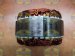 231038R | REGENERACJA | Stojan alternatora 83613781 [12V][90A] 231038R 83613781